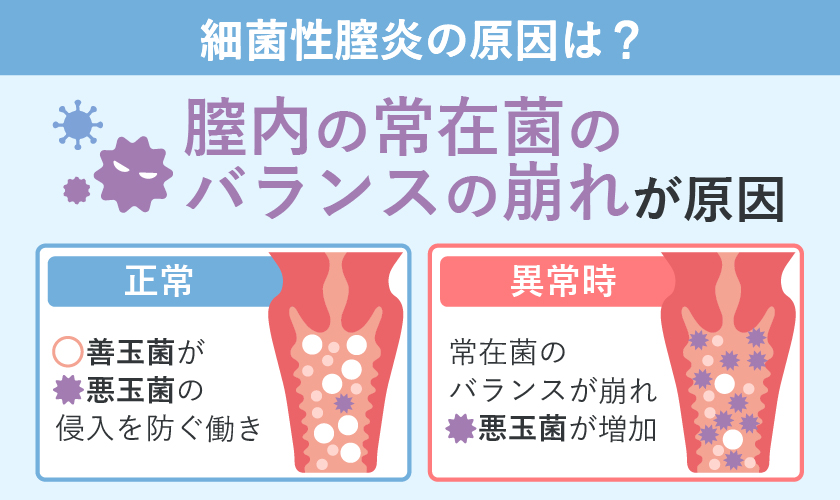 細菌性腟炎の原因