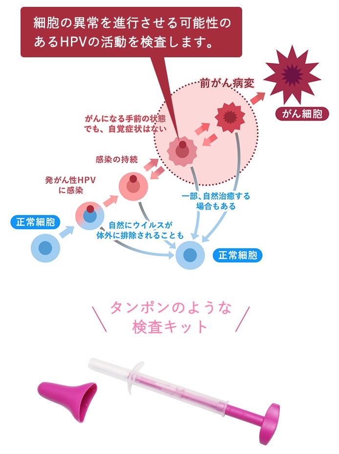 タンポンのような検査キットで、細胞の異常を進行させる可能性のあるHPVの活動を検査します。