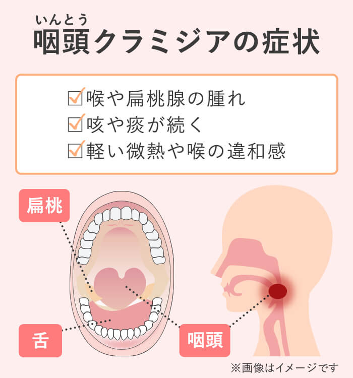 クラミジアの喉の症状