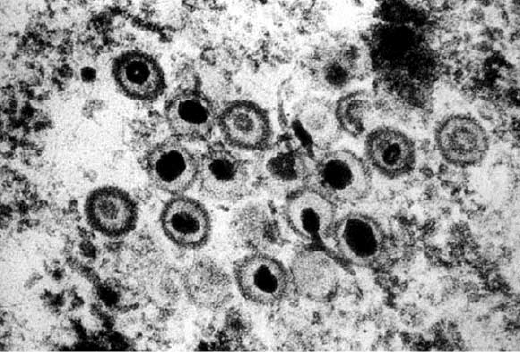 ヘルペスウイルスのイメージ