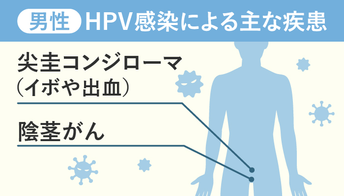 HPV感染症男性の症状