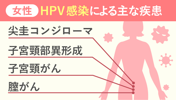 HPV感染症女性の症状