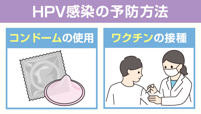 HPV感染の予防方法