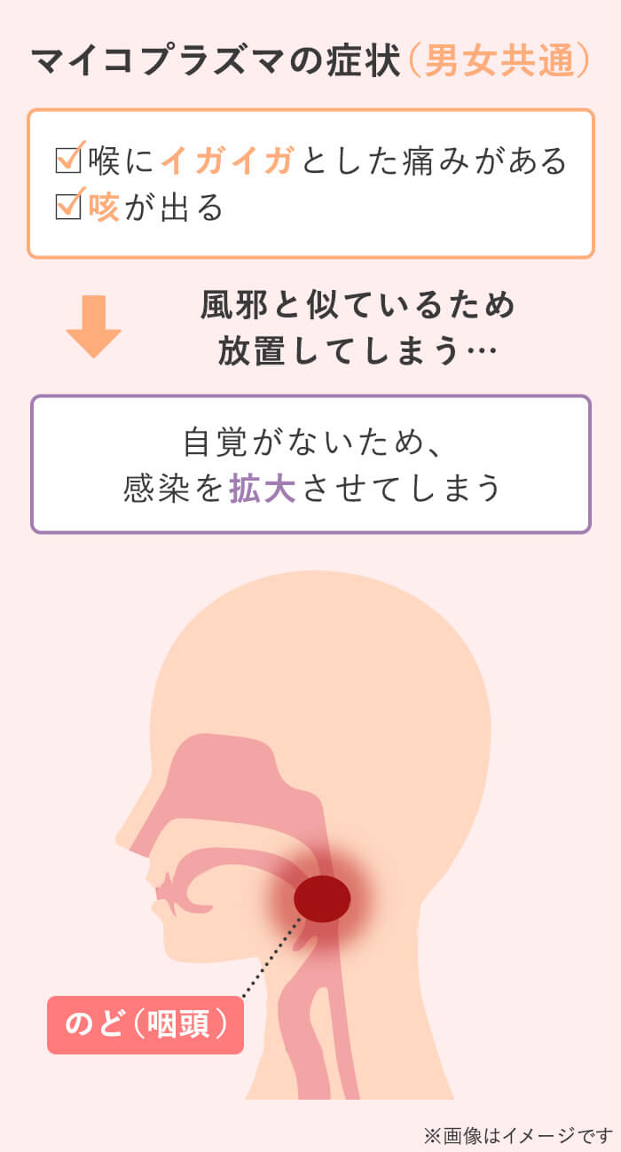 マイコプラズマの症状 (男女共通)：喉にイガイガとした痛みがある・咳が出る。風邪と似ているため放置してしまう･･･自覚がないため、 感染を拡大させてしまう