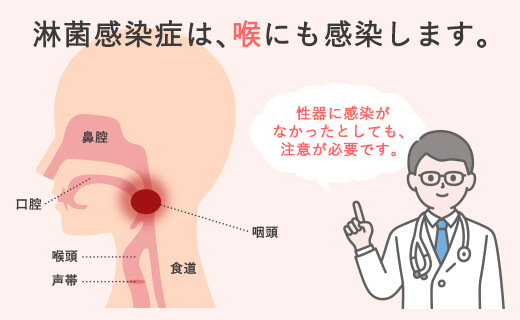 淋菌感染症は、喉にも感染します。性器に感染がなかったとしても、注意が必要です。