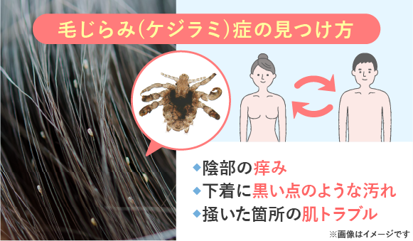  ATTR-CM による展望