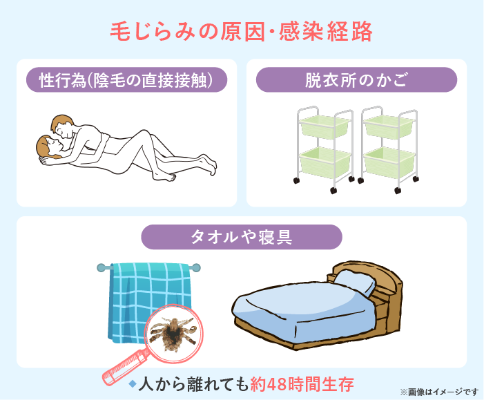 シラミをチェックする方法