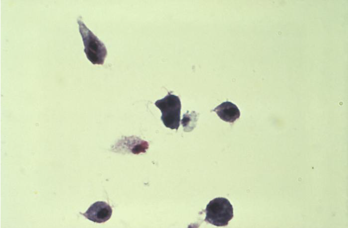 トリコモナス（Trichomonas vaginalis）のギムザ染色標本の顕微鏡写真