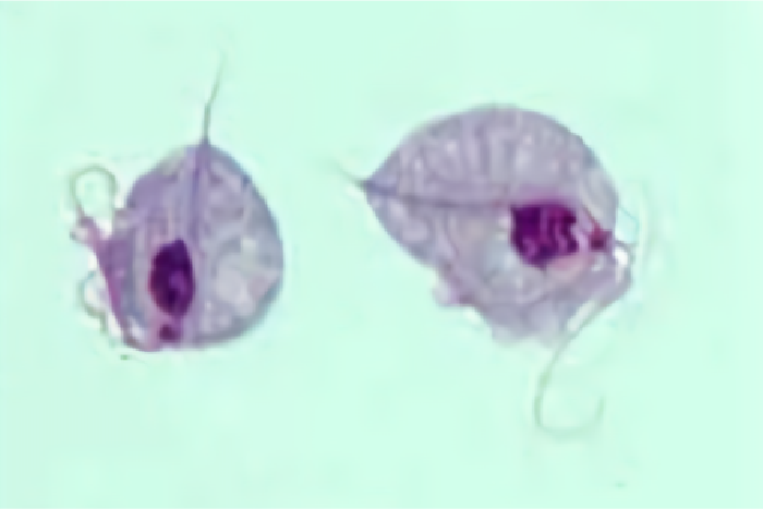 トリコモナス膣炎寄生虫2匹の拡大写真（顕微鏡で見たところ）