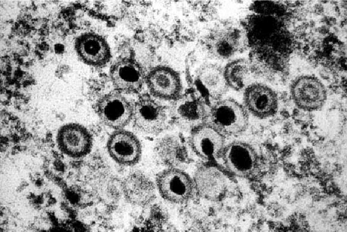 単純ヘルペスウイルス2型の電子顕微鏡像